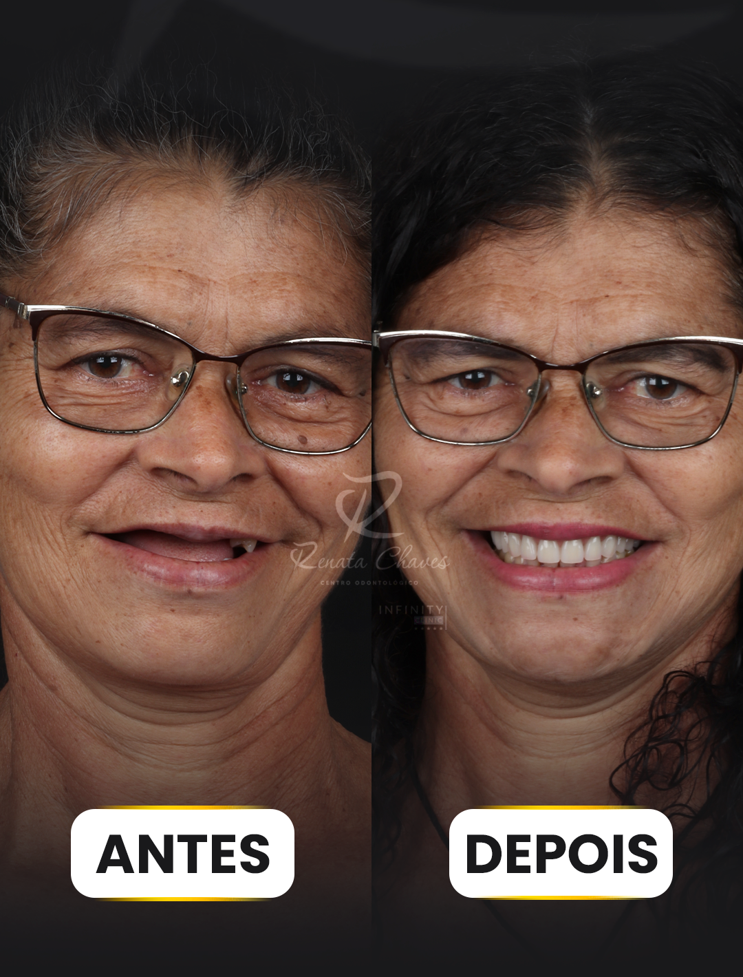 ANTES E DEPOIS 1 copiar
