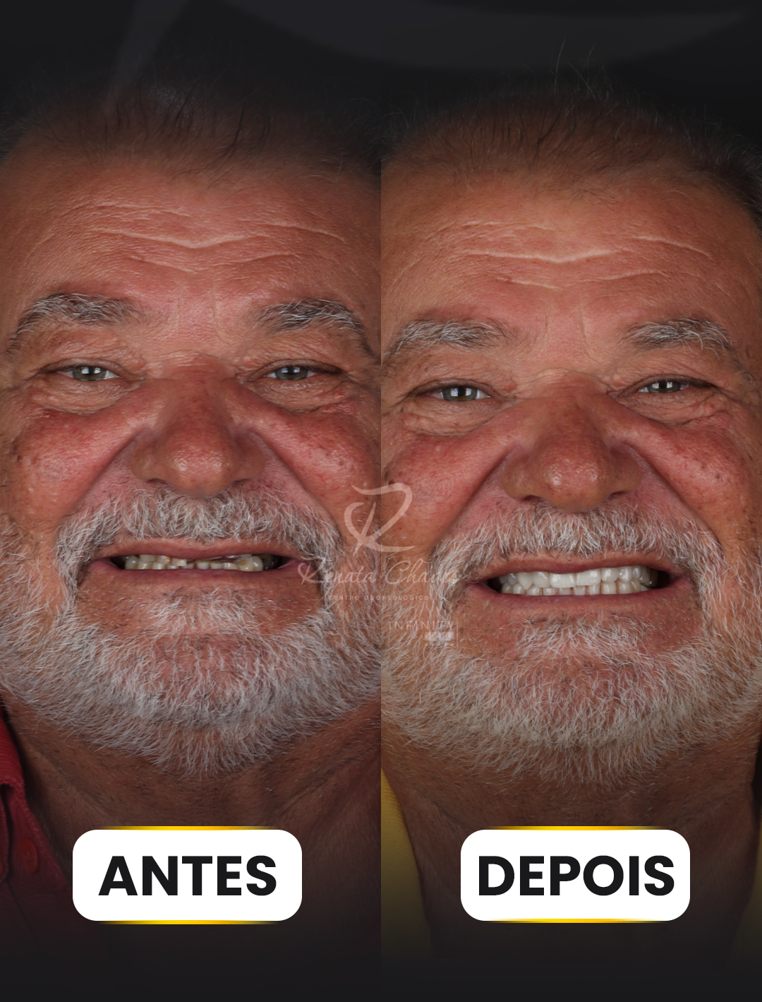 ANTES E DEPOIS 2 copiar
