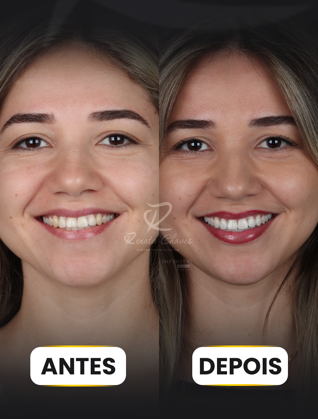 ANTES E DEPOIS 3 copiar