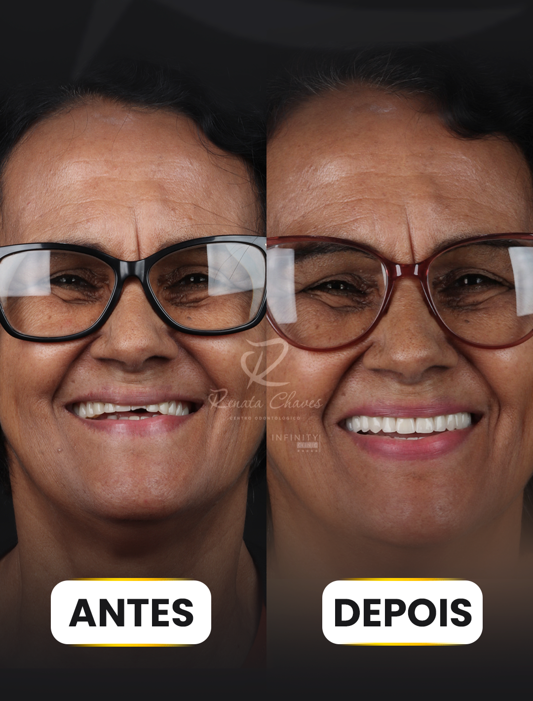ANTES E DEPOIS 4 copiar