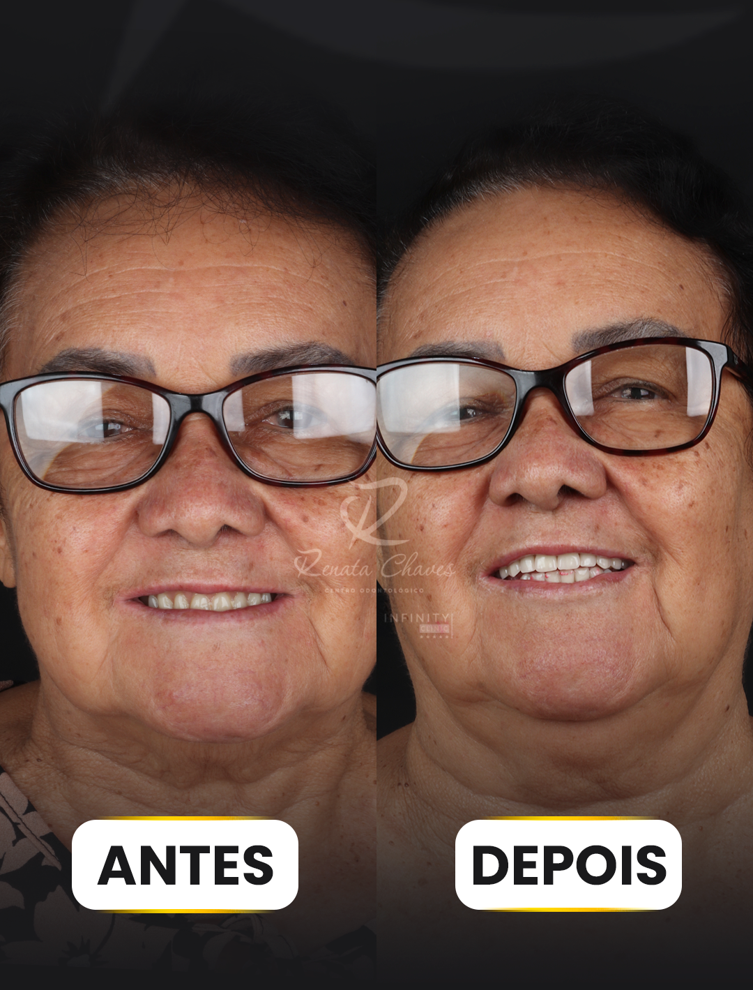 ANTES E DEPOIS 5 copiar