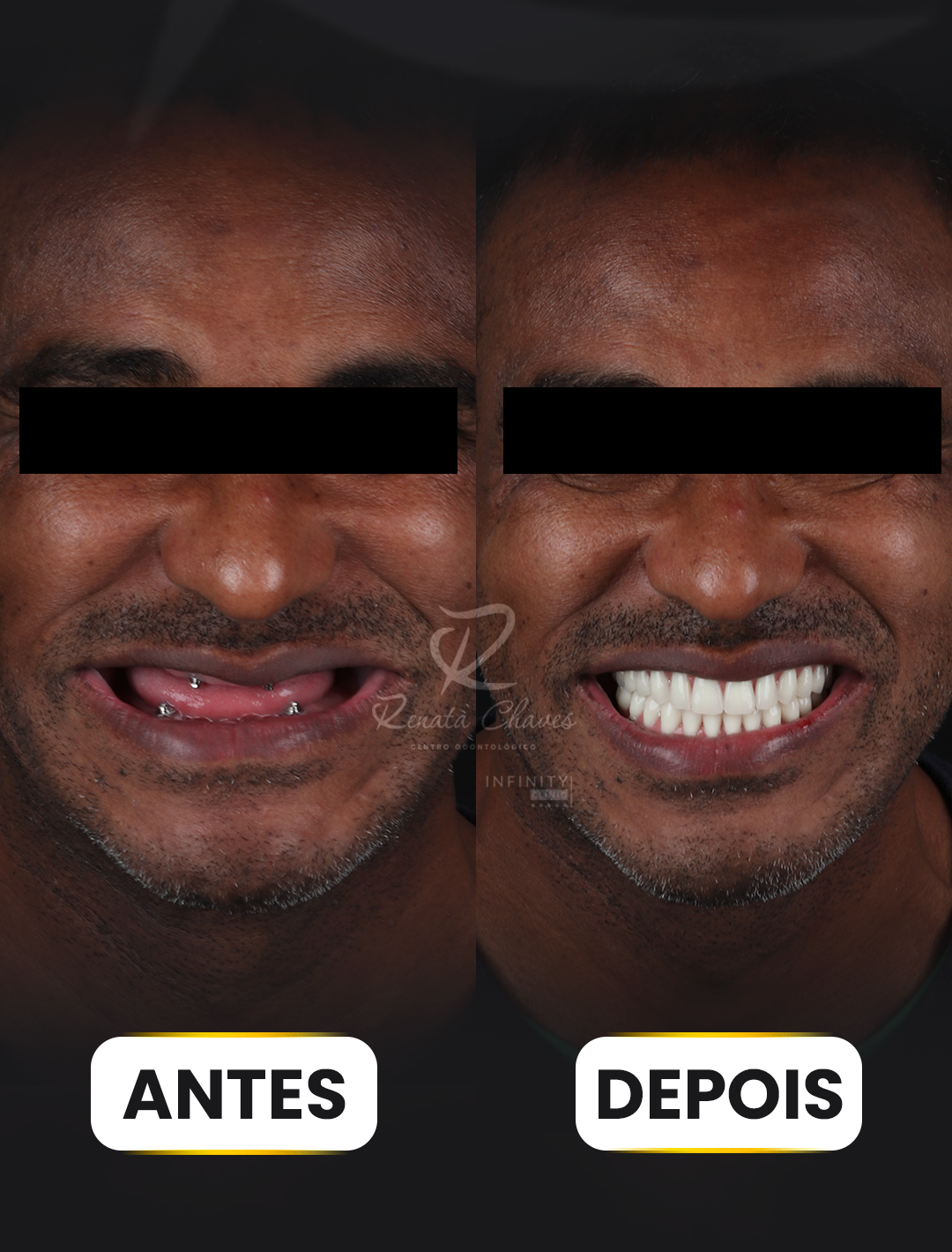 ANTES E DEPOIS 7 copiar