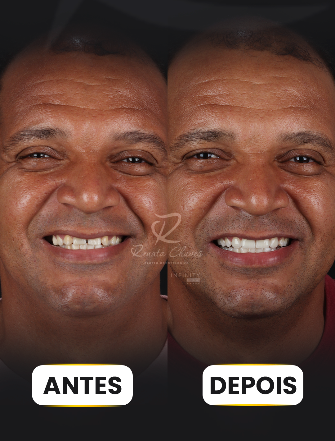 ANTES E DEPOIS 8 copiar